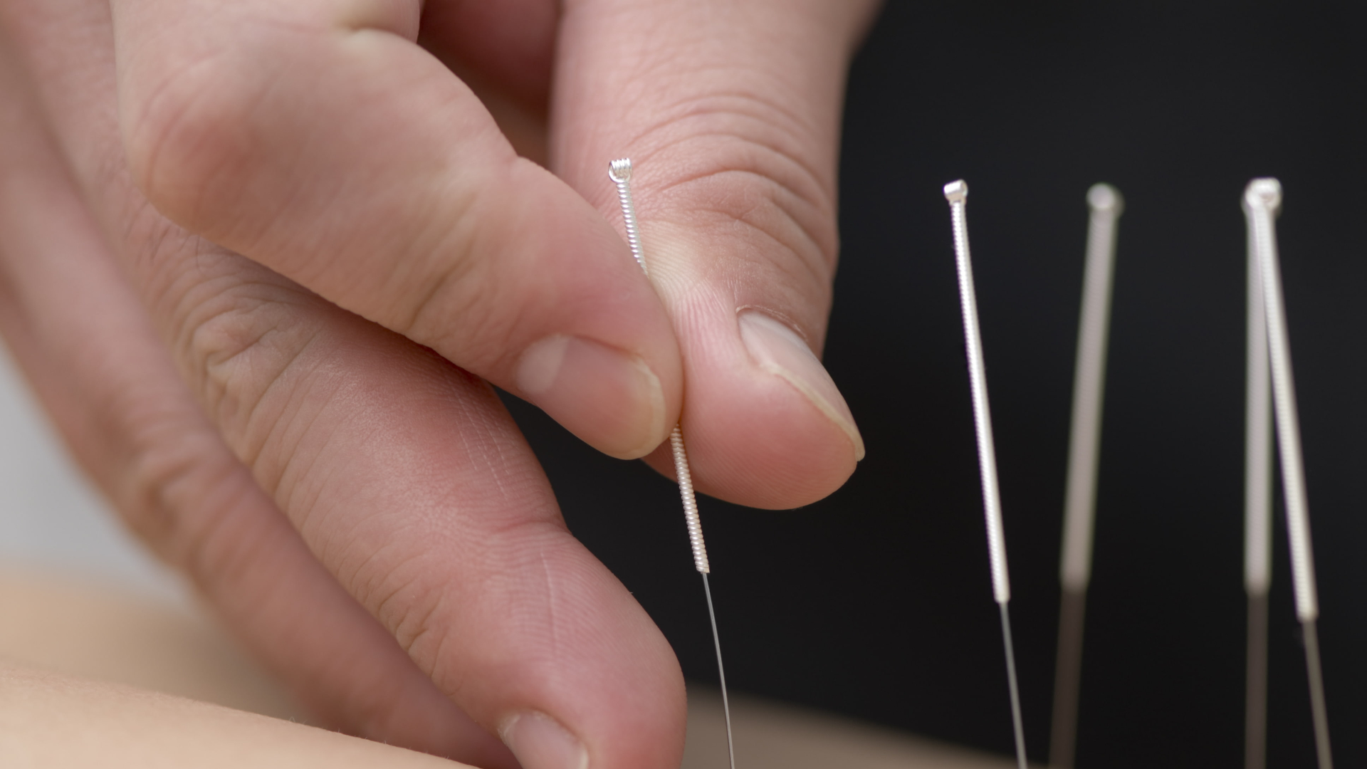 Acupuncture Injection Therapy Training