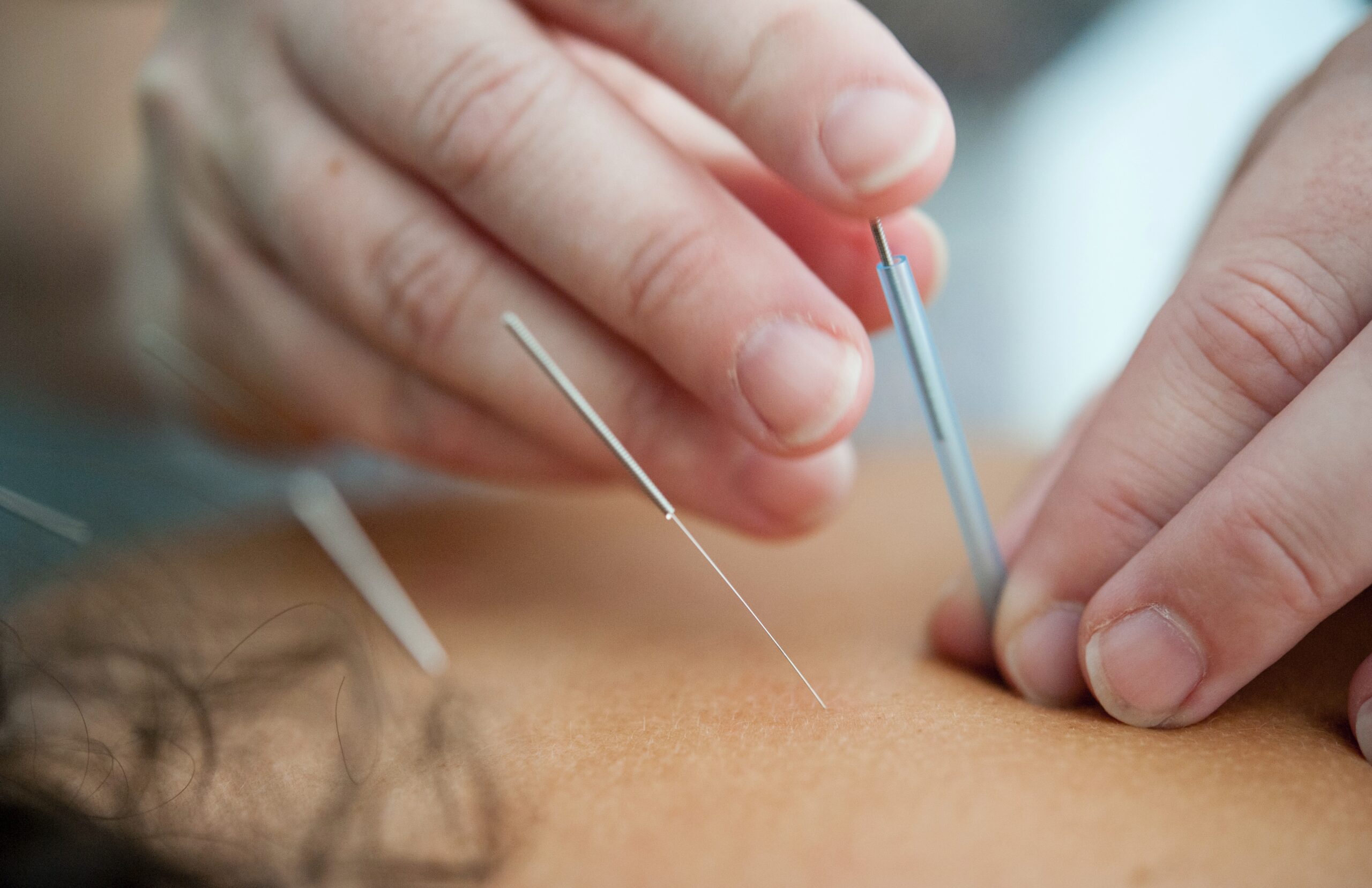 Acupuncture Point Injection Training
