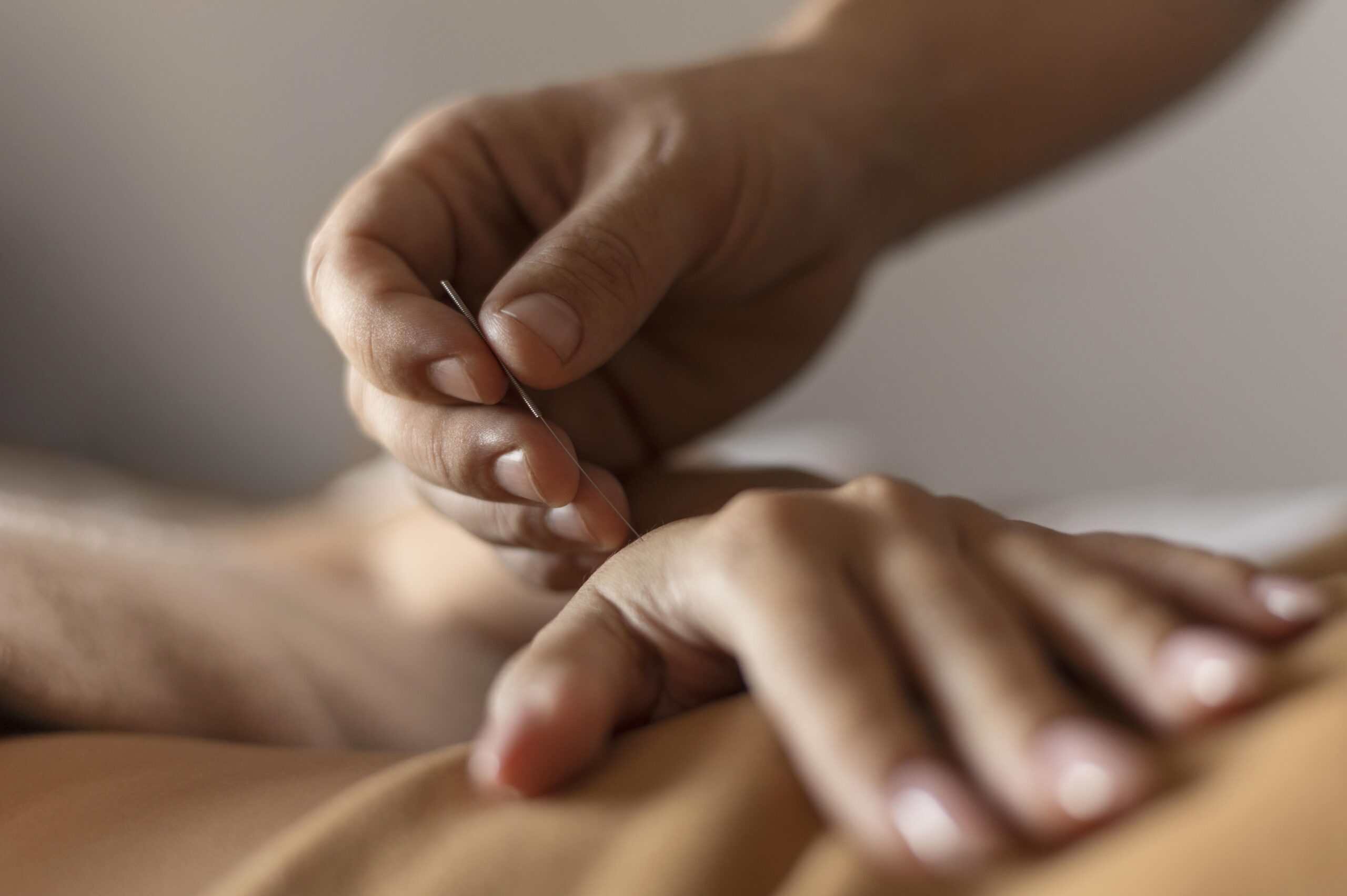 HOW TO USE ACUPUNCTURE FOR HAND PAIN RELIEF