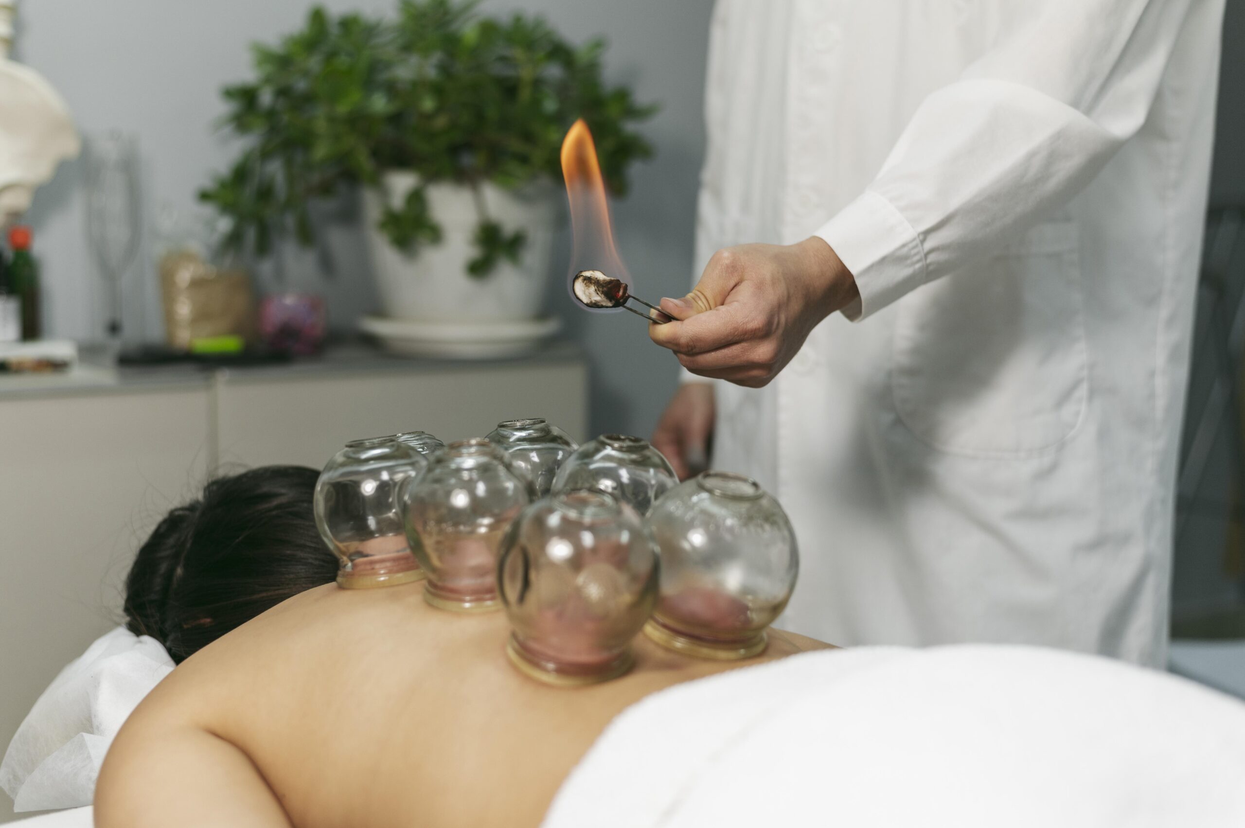 CUPPING THERAPY: A COMPREHENSIVE GUIDE