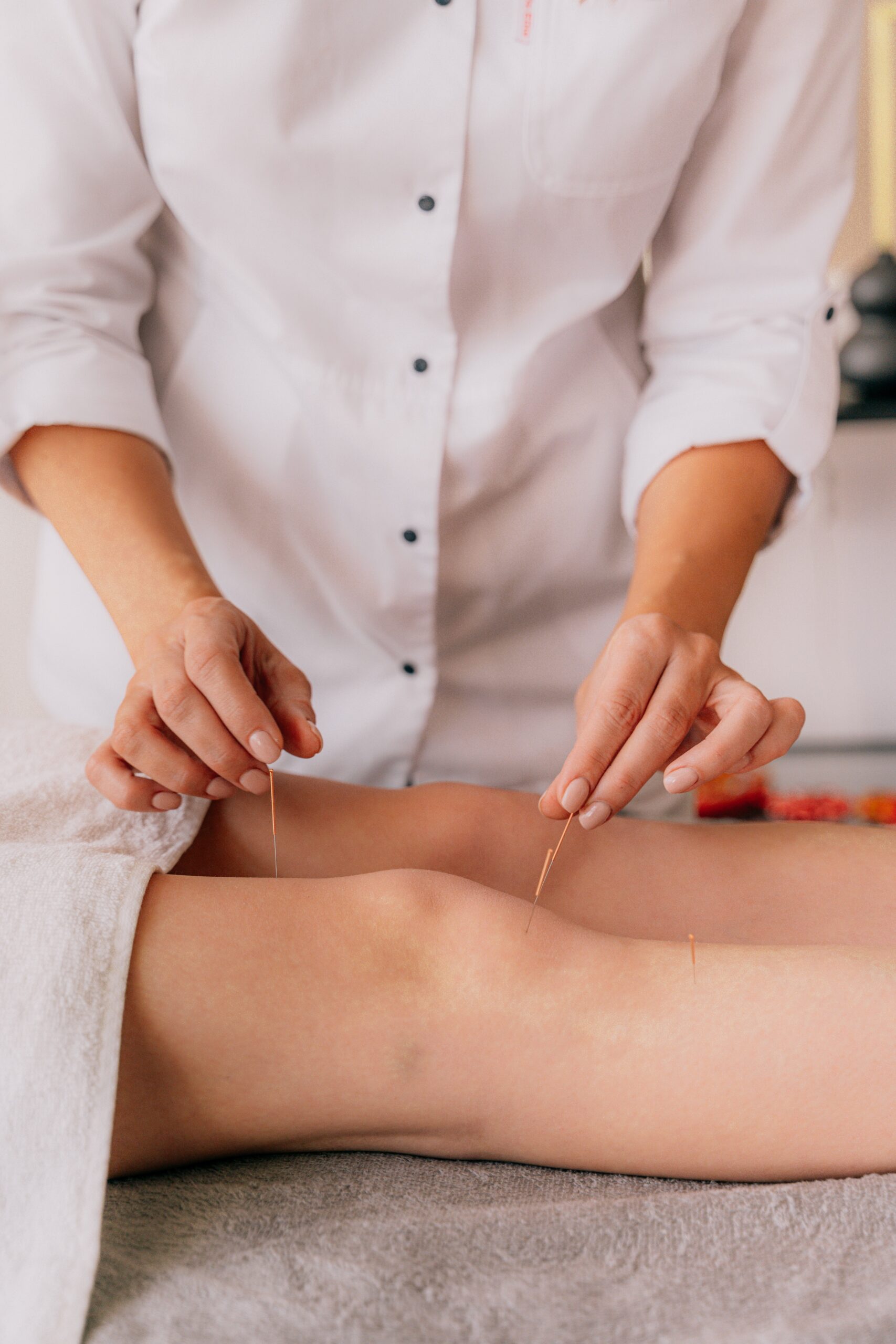 HOW TO USE ACUPUNCTURE FOR KNEE PAIN MANAGEMENT