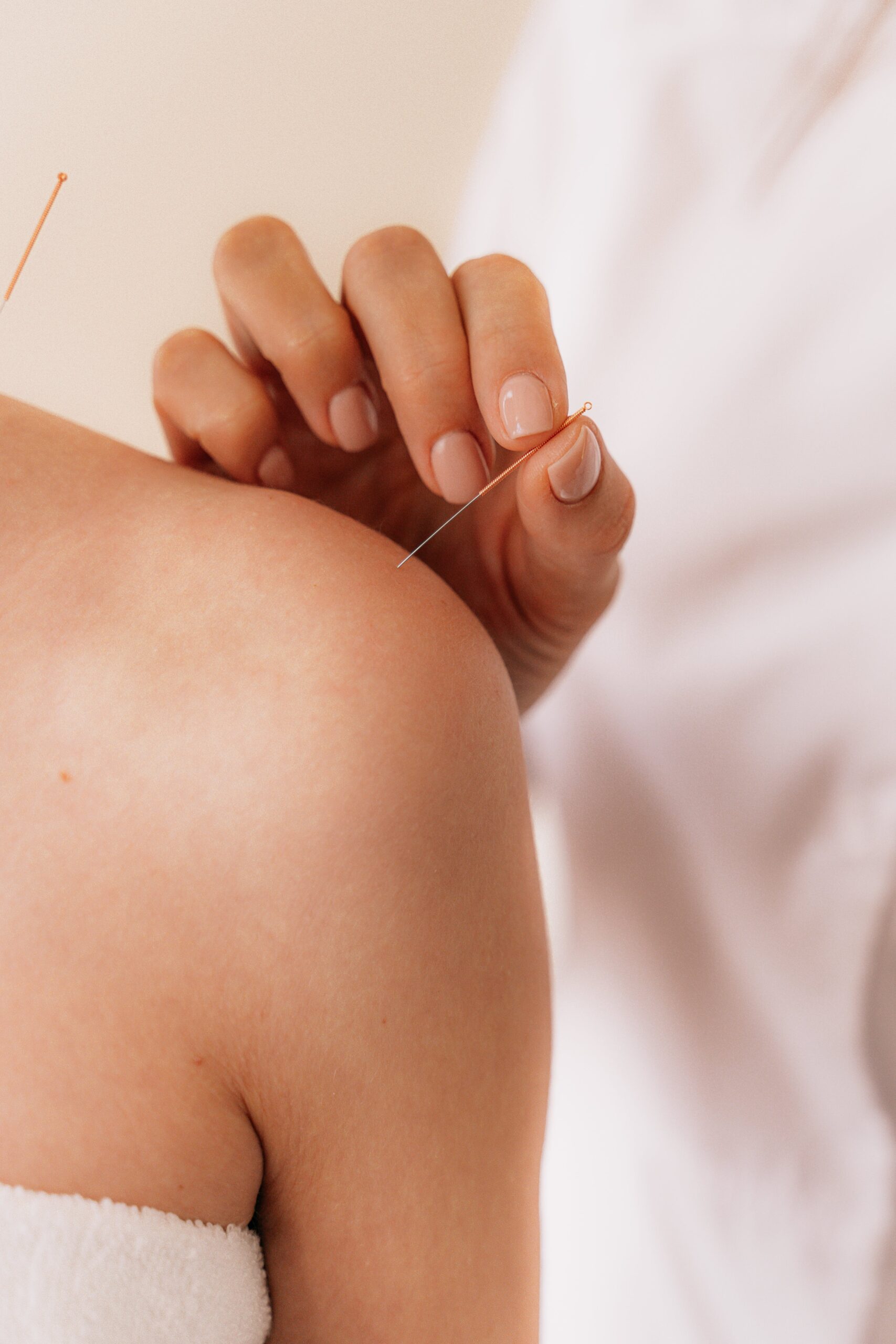 HOW TO USE ACUPUNCTURE FOR ROTATOR CUFF PAIN RELIEF