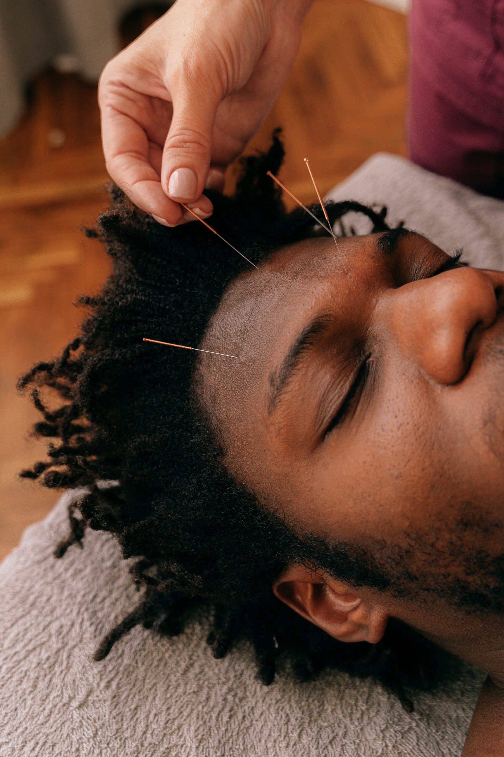 HOW TO INCORPORATE ACUPUNCTURE INTO YOUR MINDFULNESS PRACTICE